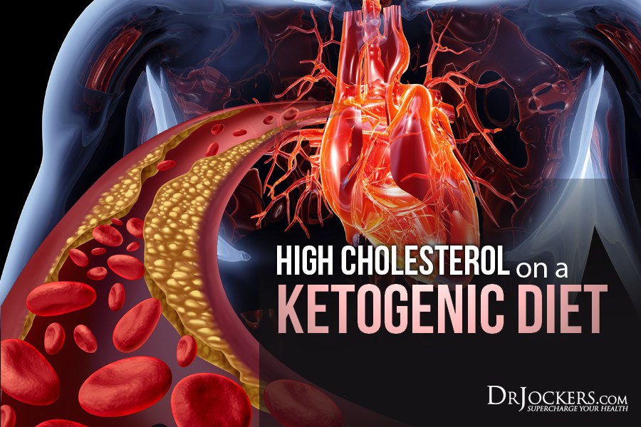 Keto Diet And Heart Disease
 High Cholesterol on a Ketogenic t DrJockers